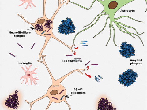 Move Over, Flortaucipir? New Tau Tracers Tested in People