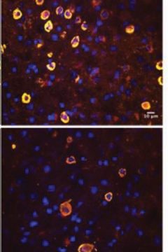 Are Tauopathies Caused by Neuronal and Glial Senescence?