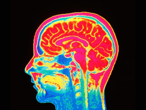 Multi-Gene Score Predicts Cognitive Decline Independently of Brain Imaging