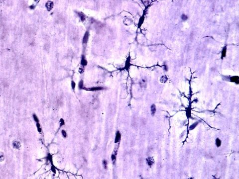 Human Microglia Make Themselves at Home in Mouse Brain