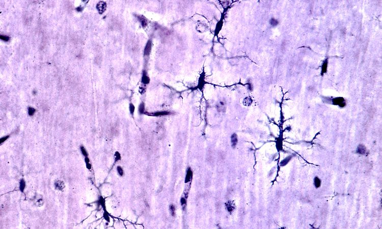 Human Microglia Make Themselves at Home in Mouse Brain