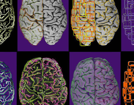 Human Amyloid Imaging Conference