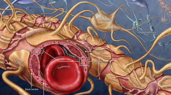 Does a Breached Blood-Brain Barrier Cause Seizures in AD?