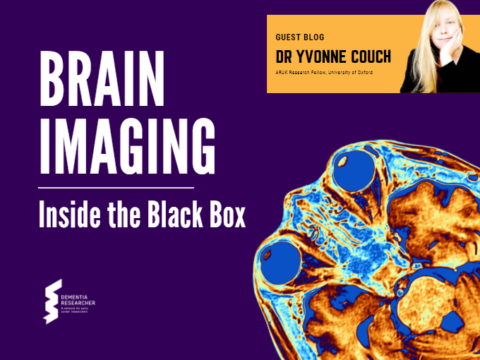 Blog – Brain Imaging, Inside The Black Box