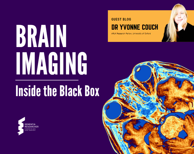 Guest Blog – Brain Imaging, Inside The Black Box