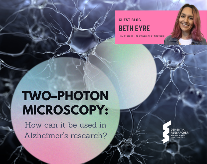 Blog – Two–photon microscopy: How can it be used in Alzheimer’s research?