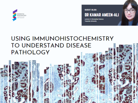 Blog – Using immunohistochemistry to understand disease pathology