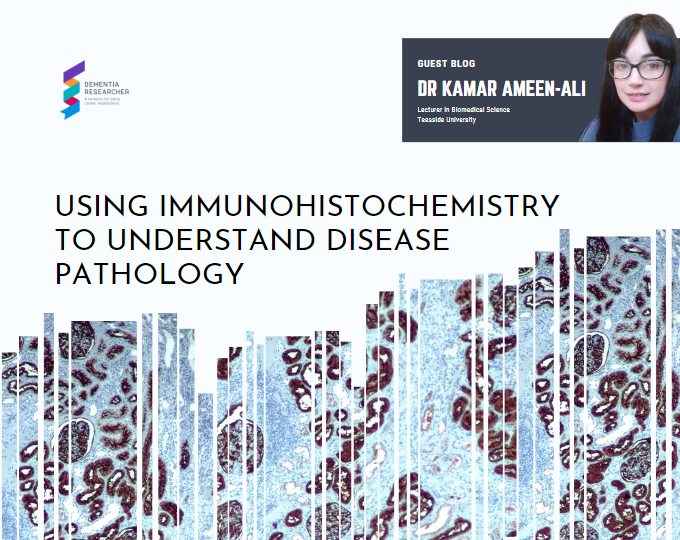 Guest Blog – Using immunohistochemistry to understand disease pathology