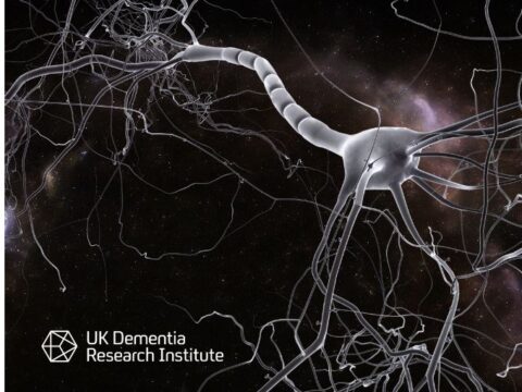 New study discovers how neurons die in Alzheimer’s disease