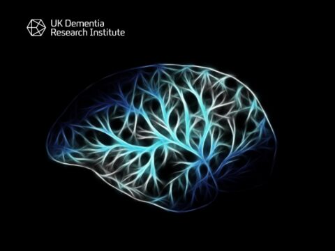 New non-invasive deep brain stimulation