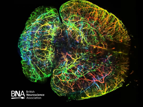 3D imaging of entire brains with light sheet microscopy
