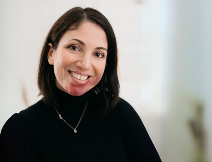 Profile – Dr Maria Teresa Ferretti, Karolinska Institutet