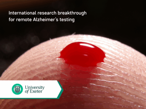 Research breakthrough for remote Alzheimer’s testing