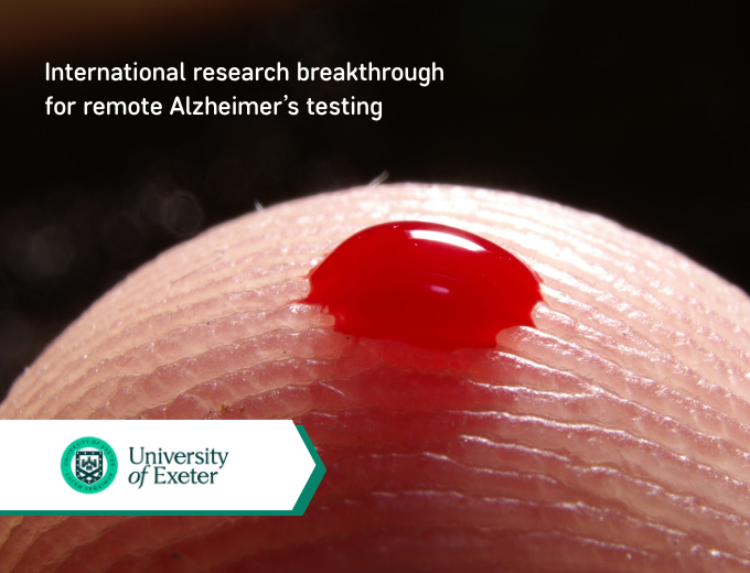 Research breakthrough for remote Alzheimer’s testing