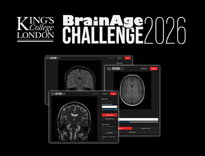 The BrainAge Challenge 2026