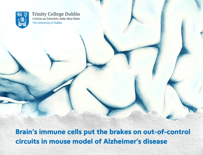Brain’s Immune Cells Rein in Alzheimer’s Brain Circuits
