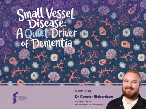 Blog – Small Vessel Disease: A Quiet Driver of Dementia