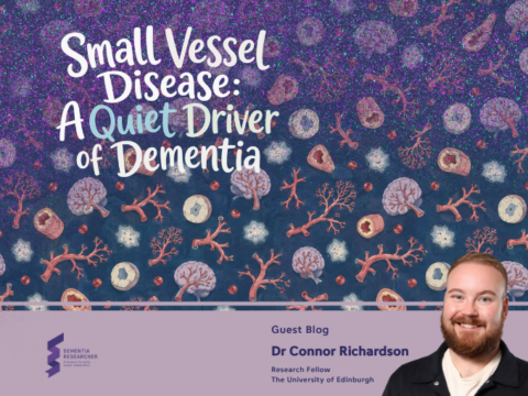 Blog – Small Vessel Disease: A Quiet Driver of Dementia