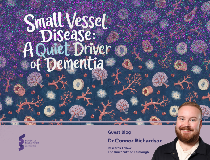 Blog – Small Vessel Disease: A Quiet Driver of Dementia