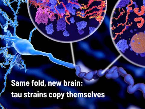 Tau strains keep their shape as they spread, mouse study shows